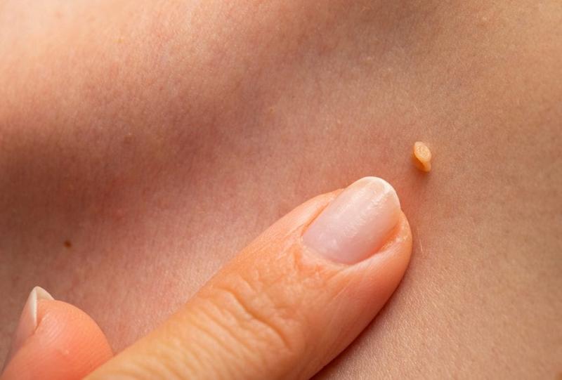 Zapobieganie chorobom u psów