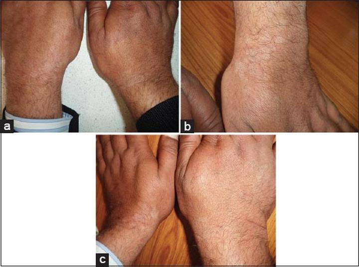 Infekcje skórne psa