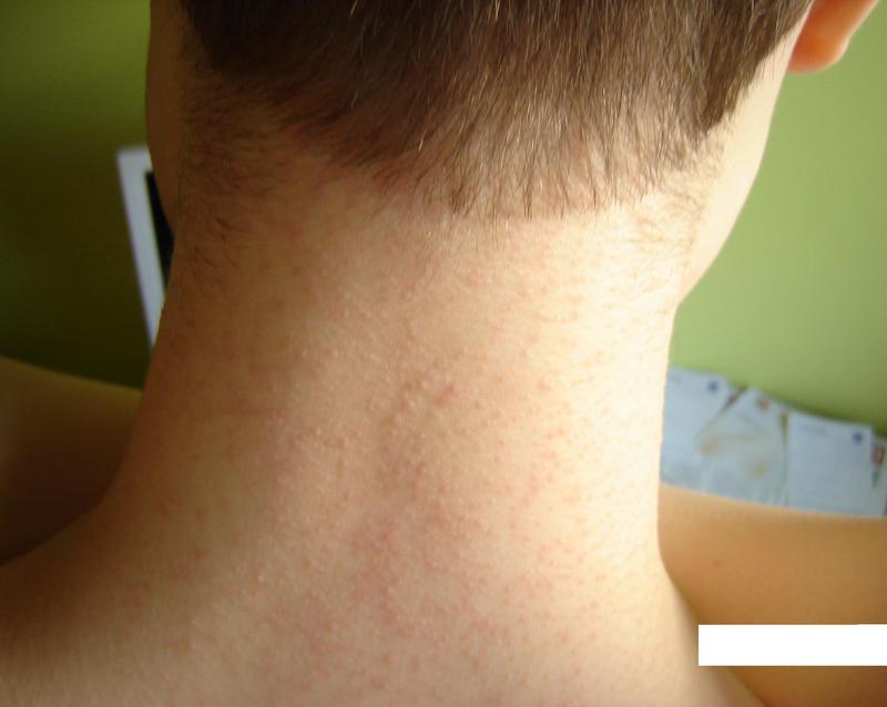 Malassezia u psa – poznaj tajemnice chorób skóry naszych czworonożnych przyjaciół