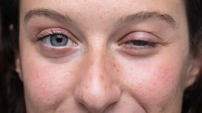 Zanik mięśni u psa: objawy, przyczyny i skuteczne metody leczenia miastenii